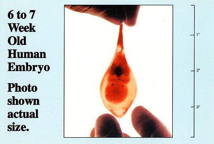 6 to 7 Week Old Human Embryo